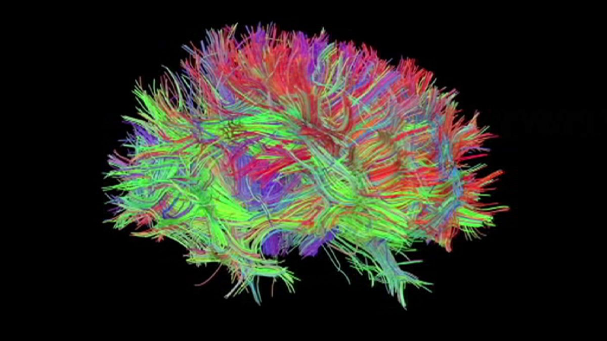 ساخت اولین تمام نگاری لیزری از رشته های عصبی مغز
