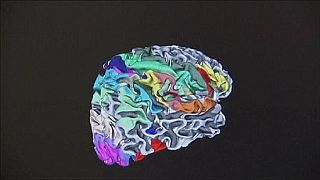 "Holoxica", l'hologramme qui permet de voyager à l'intérieur du cerveau