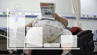 Obesity and overweight 'on the rise in nearly every country'