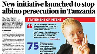 UN supports albinism Forum in Tanzania