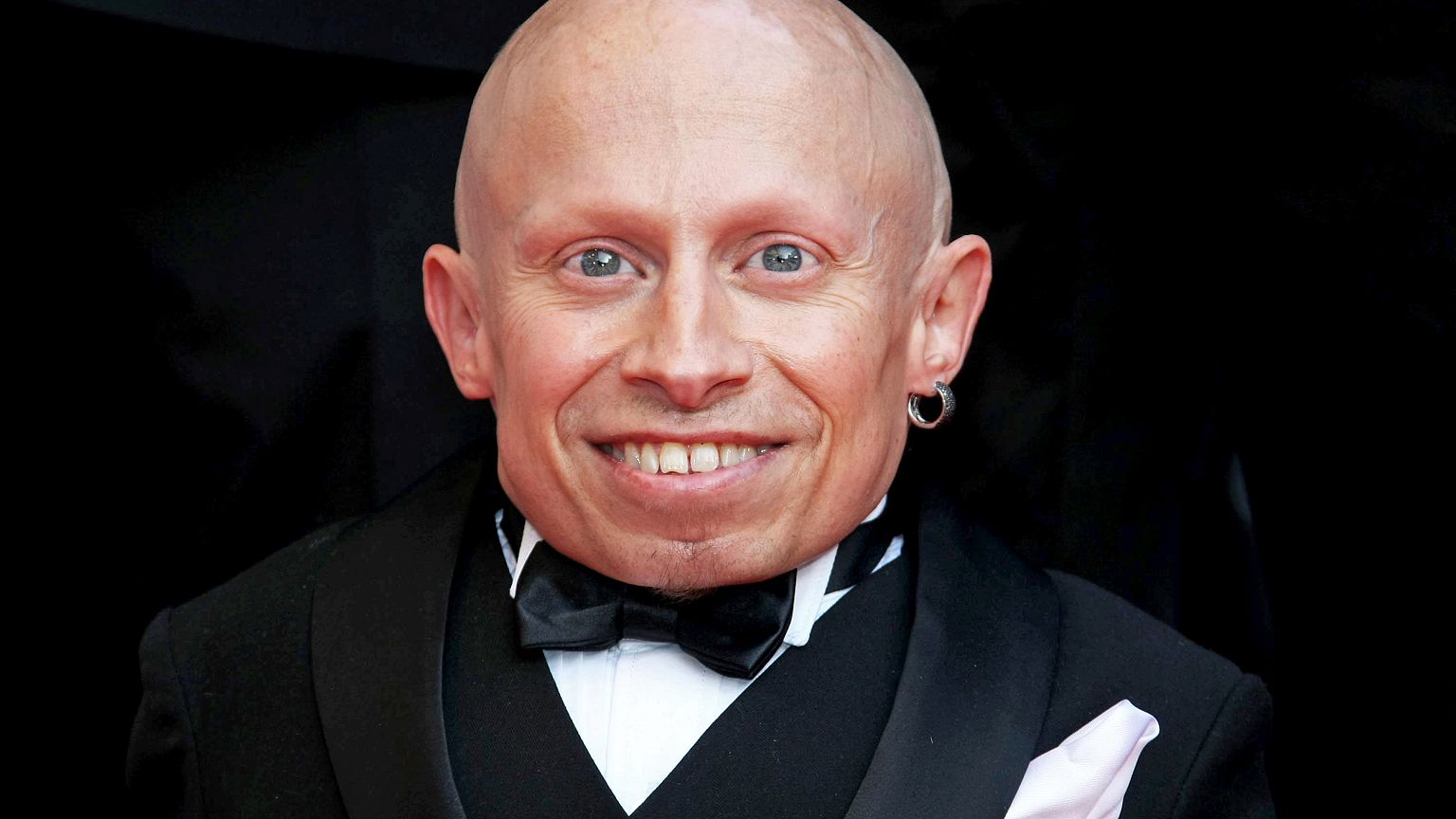 Image: FILE: Verne Troyer Dies At 49