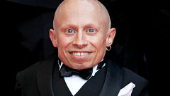 Image: FILE: Verne Troyer Dies At 49
