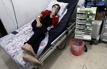 Halep'te klor gazlı saldırı