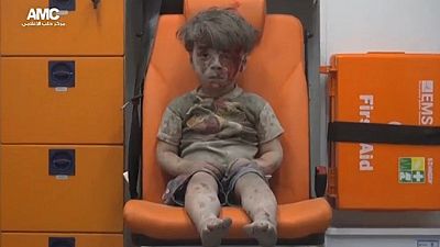 [Photo] Bloodied Syrian boy who got Twitter buzzing