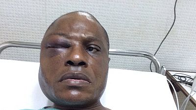 Manifestations en RDC : le député Martin Fayulu hospitalisé après avoir subi des violences