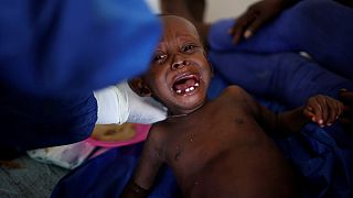 Haiti suffers upsurge in cholera in wake of Hurricane Matthew