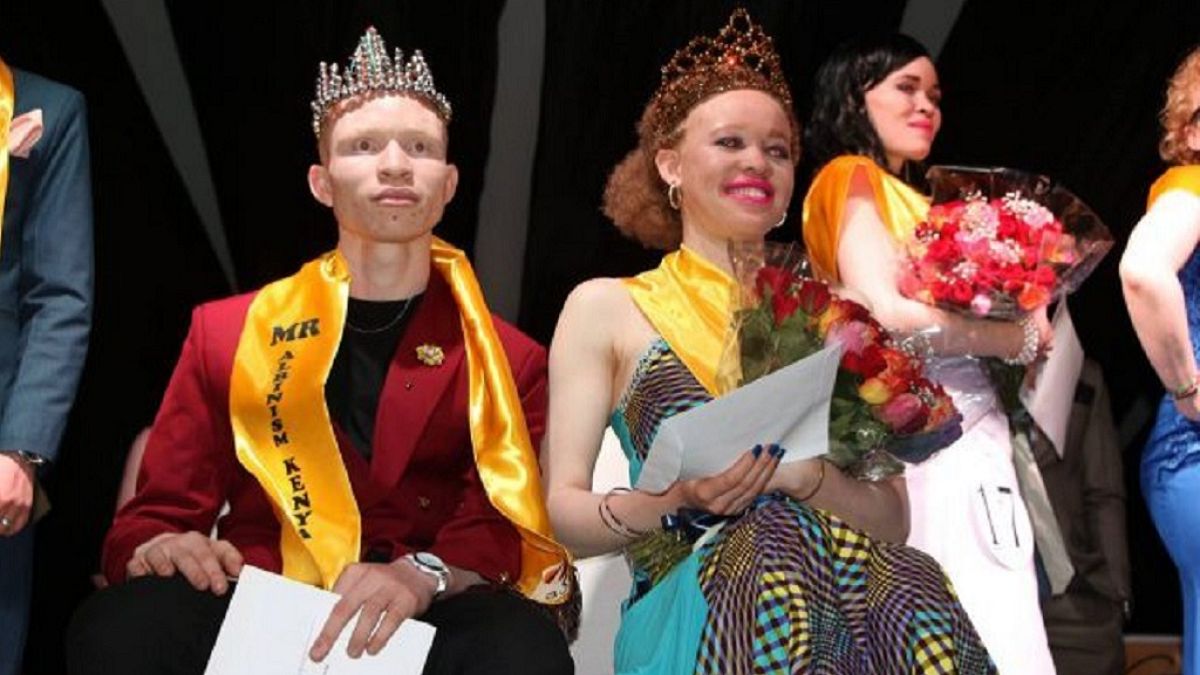 Kenya's first Mr and Miss Albinism crowned