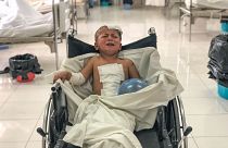 Image: Children in hospital after aisrtrikes in Afghanistan