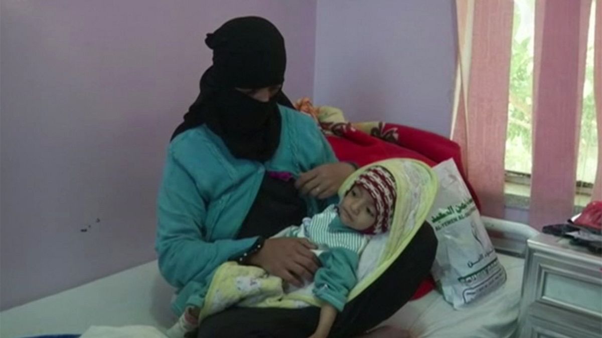 В Йемене дети умирают от холеры и голода