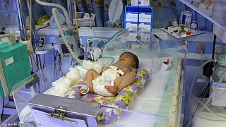 مسمومیت خونی، شایع‌ترین علت مرگ و میر در نوزادی در ایران