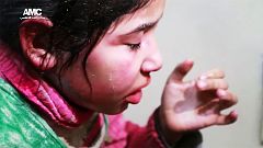 Verletzte Kinder nach Bombenangriff in Aleppo