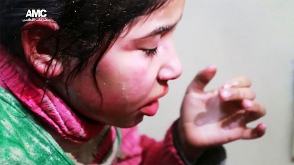 Tras cada bombardeo en Alepo niños heridos acuden al hospital Tras cada bombardeo en Alepo niños heridos acuden al hospital