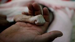 Image: A Picture and its Story: Yemeni father mourns baby girl who died of 