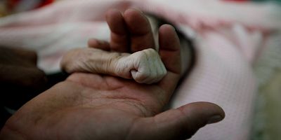 A father holds the hand of his four-month-old daughter, Hajar, who died of malnutrition in Sanaa, Yemen on November 15. An estimated 130 children in Yemen die every day of starvation and disease. 