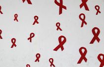 Aids hastalığı için umut verici sonuçlar