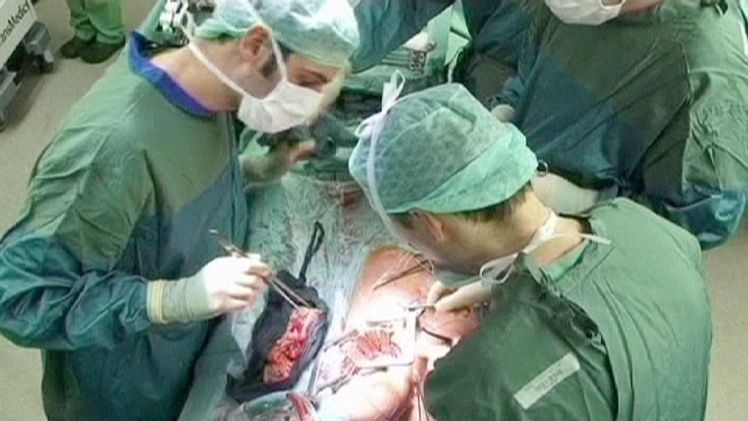 A franciáknál ezentúl mindenki potenciális szervdonor