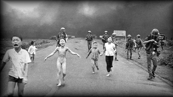 Vietnam : 44 ans après, "la fille au napalm" retrouve sa sensibilité cutanée Vietnam : 44 ans après, "la fille au napalm" retrouve sa sensibilité cutanée