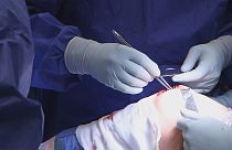 Cientistas usam células da cartilagem do nariz para tratar joelho