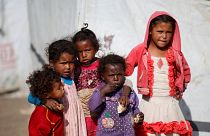 Hungersnot im Jemen: Alle zehn Minuten stirbt ein Kind