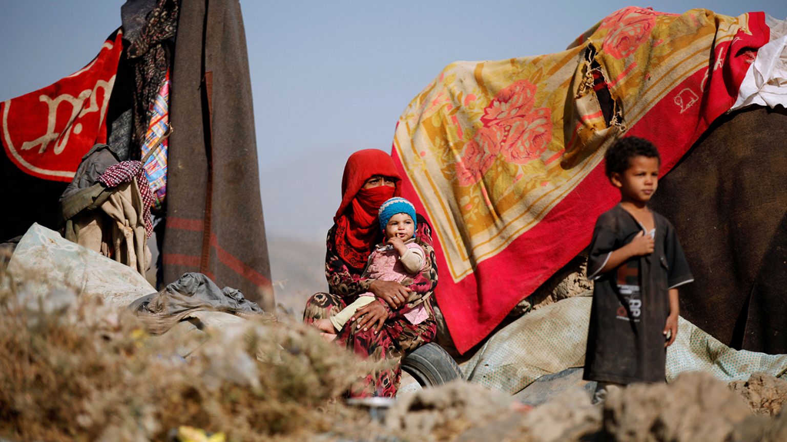 Yemen: UN says one child dies every ten minutes from a preventable disease