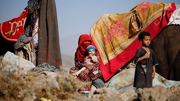 Yemen: UN says one child dies every ten minutes from a preventable disease Yemen: UN says one child dies every ten minutes from a preventable disease