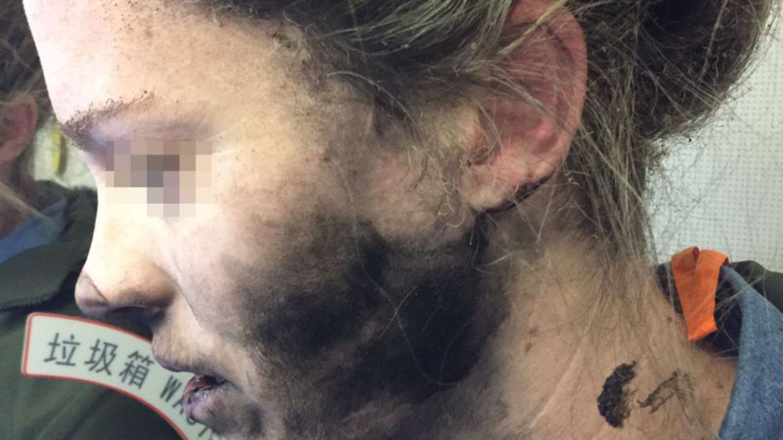 Headphone battery fire causes injury on China-Australia flight