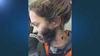 راكبة تصاب بحروق في الوجه بعد انفجار سماعاتها على متن طائرة