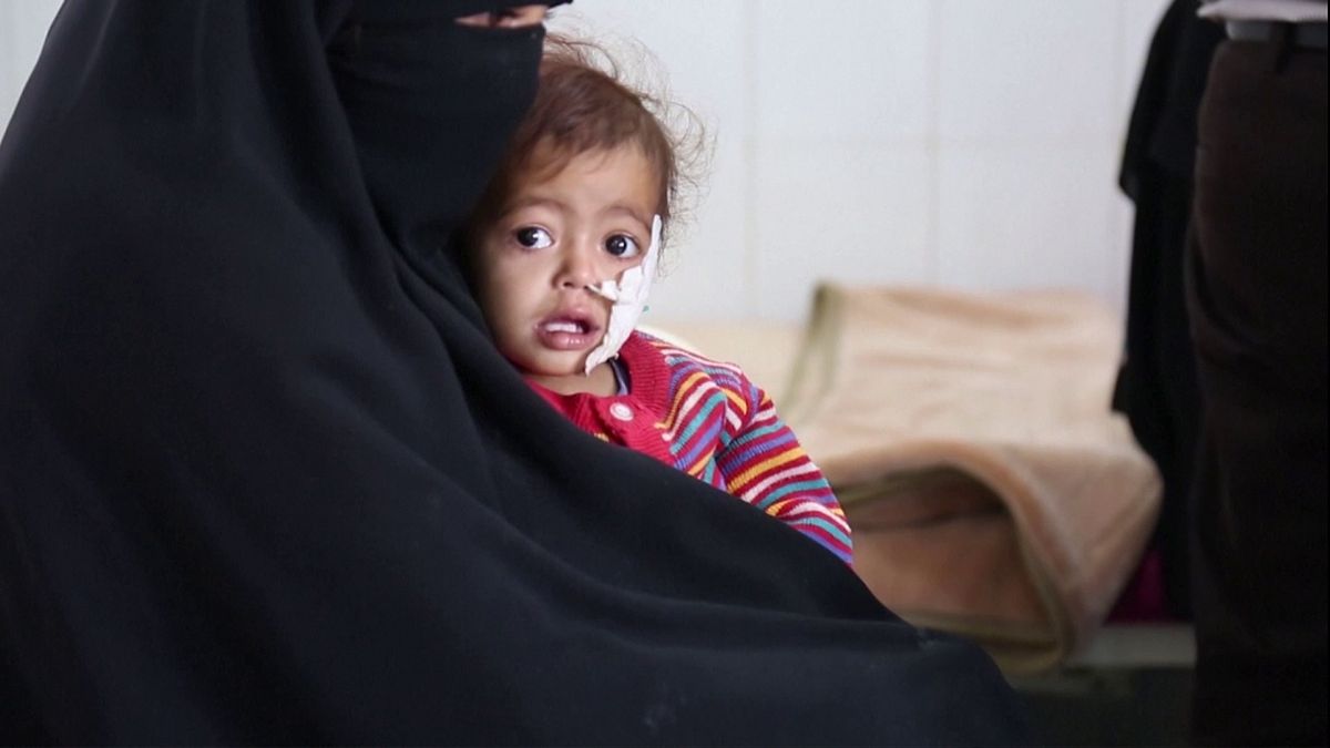 منظمة اليونيسف تحذر من خطر المجاعة التي تهدد أطفال اليمن