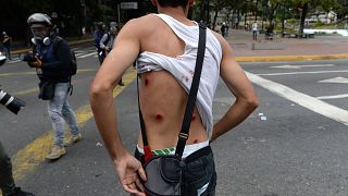 Image: A wounded protester shows his back as riot police clash with opposit