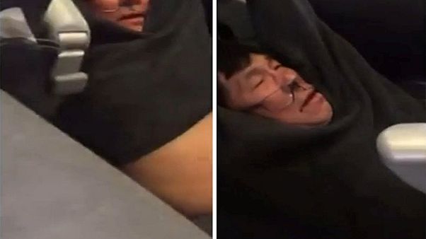 شركة يونايتد للطيران عرضة لإنتقادات في كل انحاء العالم شركة يونايتد للطيران عرضة لإنتقادات في كل انحاء العالم