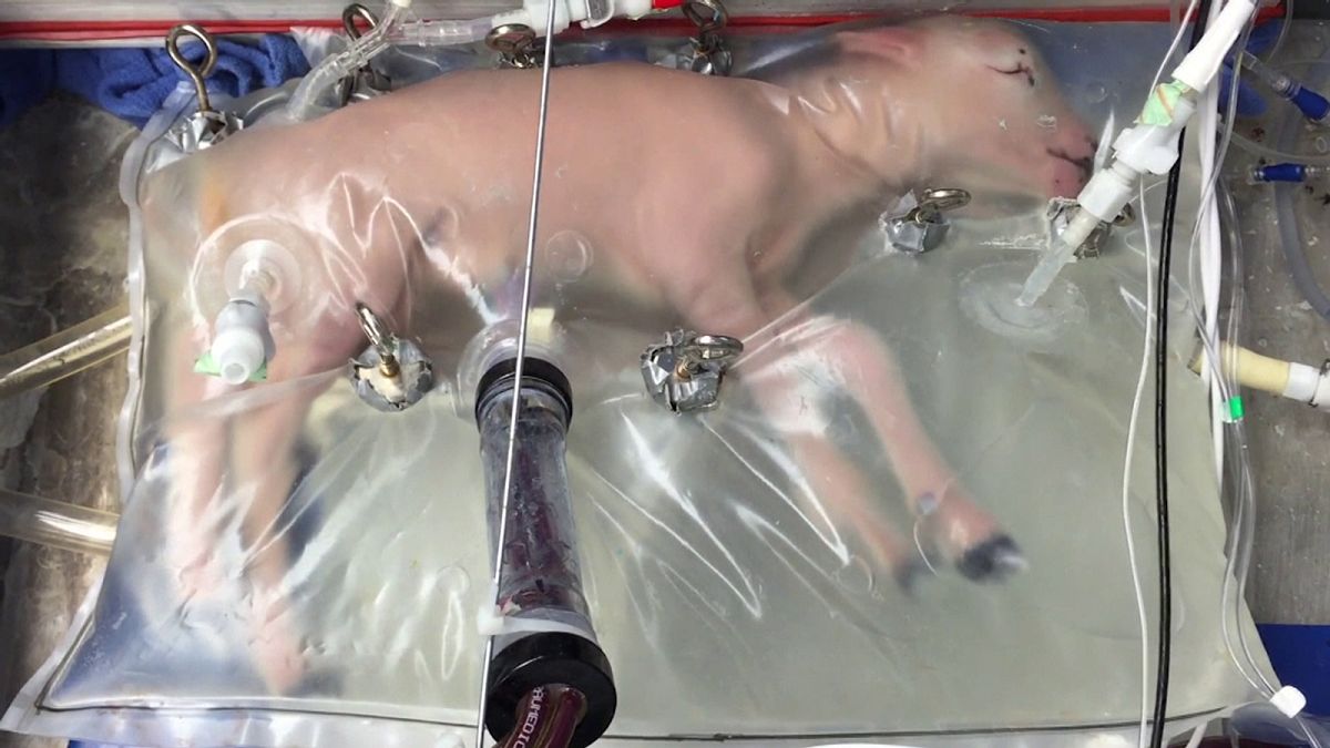 Útero artificial é esperança para bebés prematuros