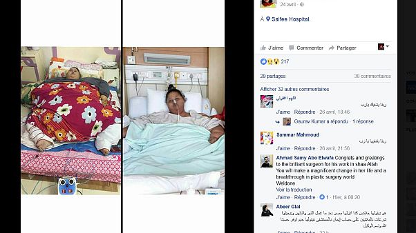 نقل إيمان أحمد "أسمن امرأة في العالم" إلى مستشفى في أبوظبي نقل إيمان أحمد "أسمن امرأة في العالم" إلى مستشفى في أبوظبي