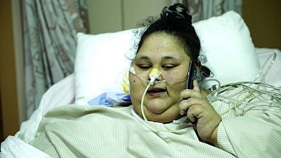 Egypt's Eman: 'world's heaviest woman' moved to UAE after India surgery