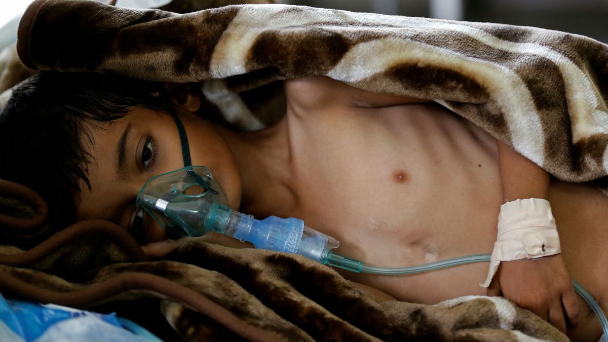 قحطی زندگی هفت میلیون یمنی را تهدید می کند