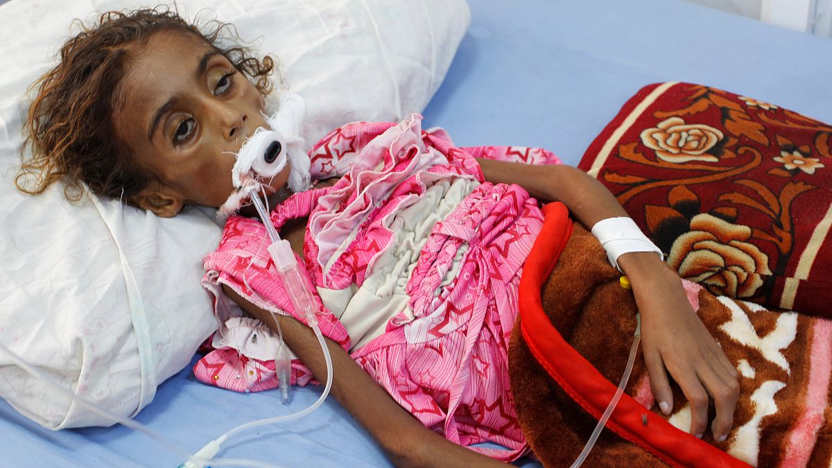 سرگذشت غم انگیز جمیله؛ دختری یمنی که از بیماری و گرسنگی جان سپرد