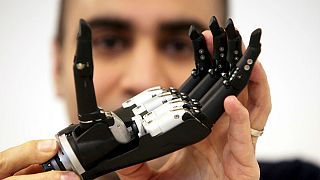 Βιονικό χέρι με τεχνητή νοημοσύνη