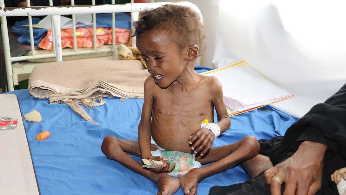 اليمن يواجه أكبر أزمة للأمن الغذائي في العالم
