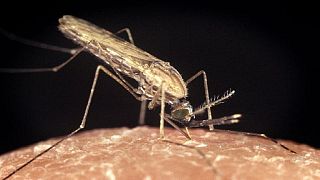 High alert over Dengue Fever as 150 cases diagnosed in Kenya's coastal region