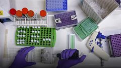 HIV'le mücadelede antiretroviral terapi yaşam süresini arttıracak