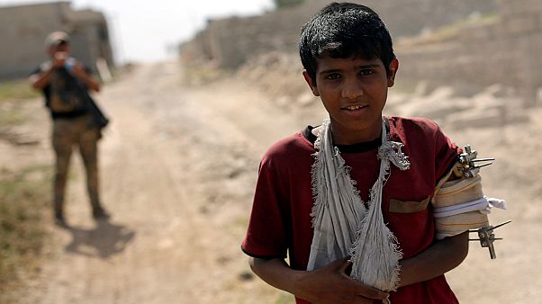 Battle for Mosul: Iraq prosthetic centre treats hundreds of war casualties Battle for Mosul: Iraq prosthetic centre treats hundreds of war casualties
