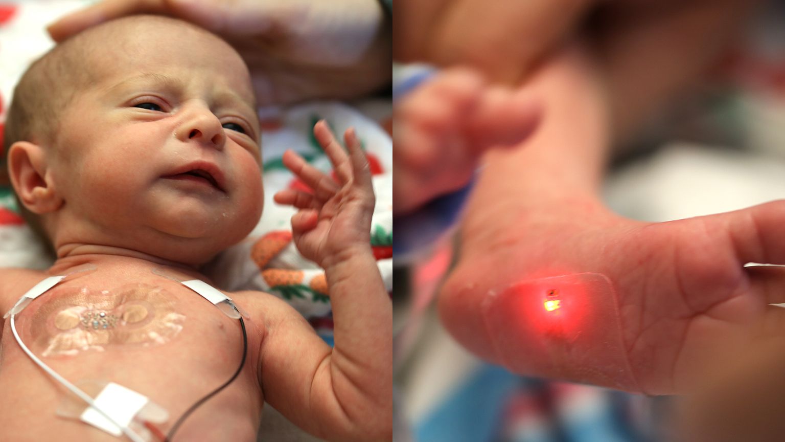 New NICU baby sensors