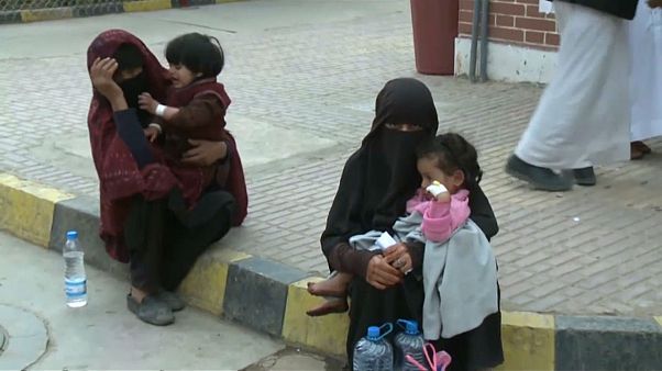 صيحة استغاثة إلى العالم لمساعدة اليمن إنسانيا صيحة استغاثة إلى العالم لمساعدة اليمن إنسانيا
