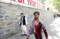 Cabul: Explosão de carro-bomba faz dezenas de mortos e centenas de feridos