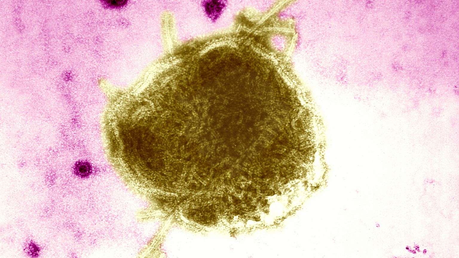 Paramyxoviridae Virus