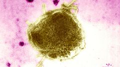 Paramyxoviridae Virus