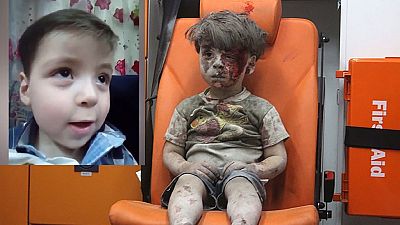 Bloodied Syrian boy whose photo went viral on Twitter in good shape now
