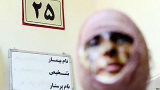 اسیدپاشی در تهران ۱۶ مصدوم برجای گذاشت