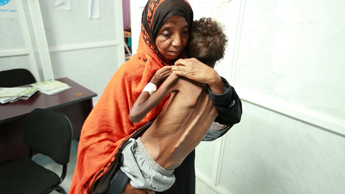 اليمنيون بين مطرقة الحرب وسندان وباء الكوليرا