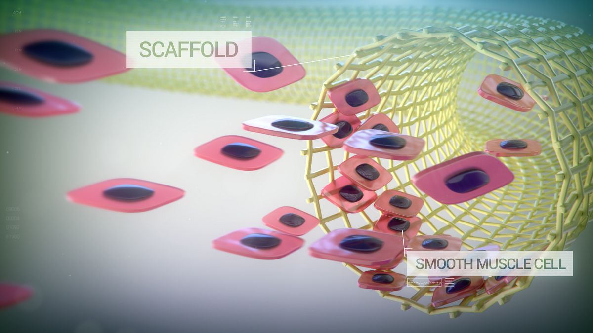 Humacyte is developing bioengineered blood vessels.