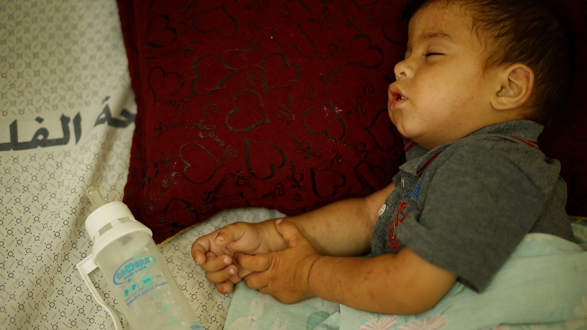 Gaza: il dramma dei reparti pediatrici